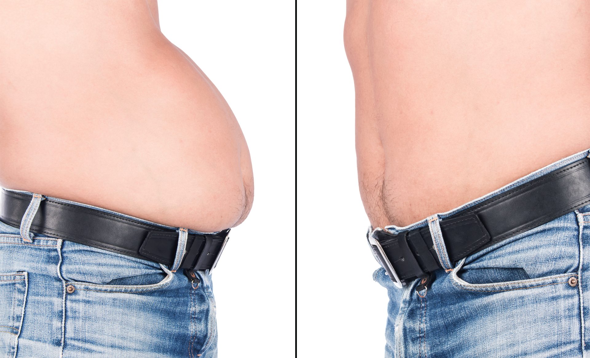 Prima e dopo dimagrimento